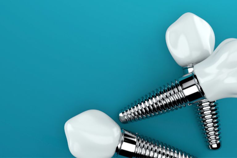 ¿Qué hacer si un implante dental se afloja?