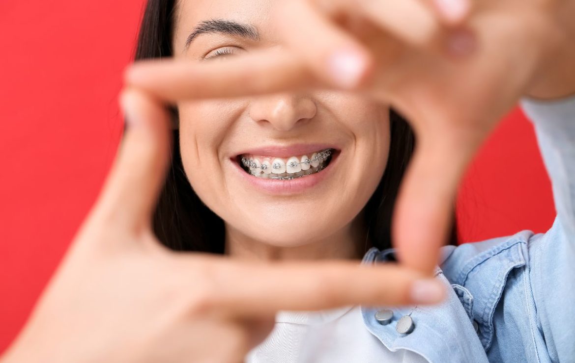 Motivos para plantearse un tratamiento de ortodoncia