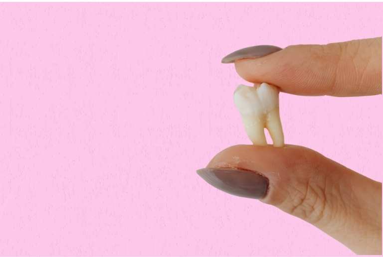 Apiñamiento dental ¿Cómo corregirlo con un tratamiento profesional?