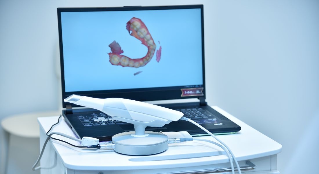 Pantalla muestra imagen digital 3d hecha con el escáner intraoral
