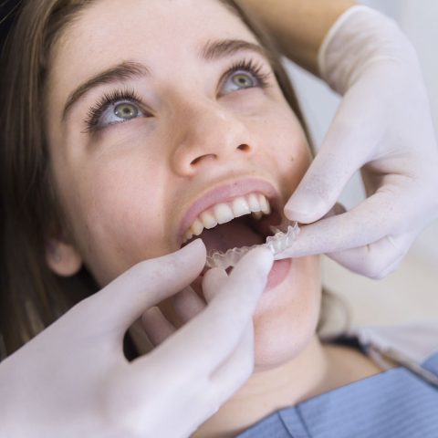 dentist-s-hand-placing-aligner-to-female-patient-s-teeth
